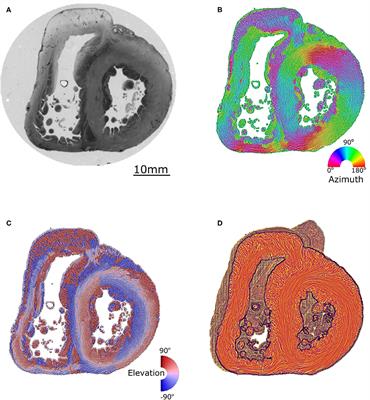 <mark class="highlighted">Polarized Light</mark> Imaging of the Myoarchitecture in Tetralogy of Fallot in the Perinatal Period